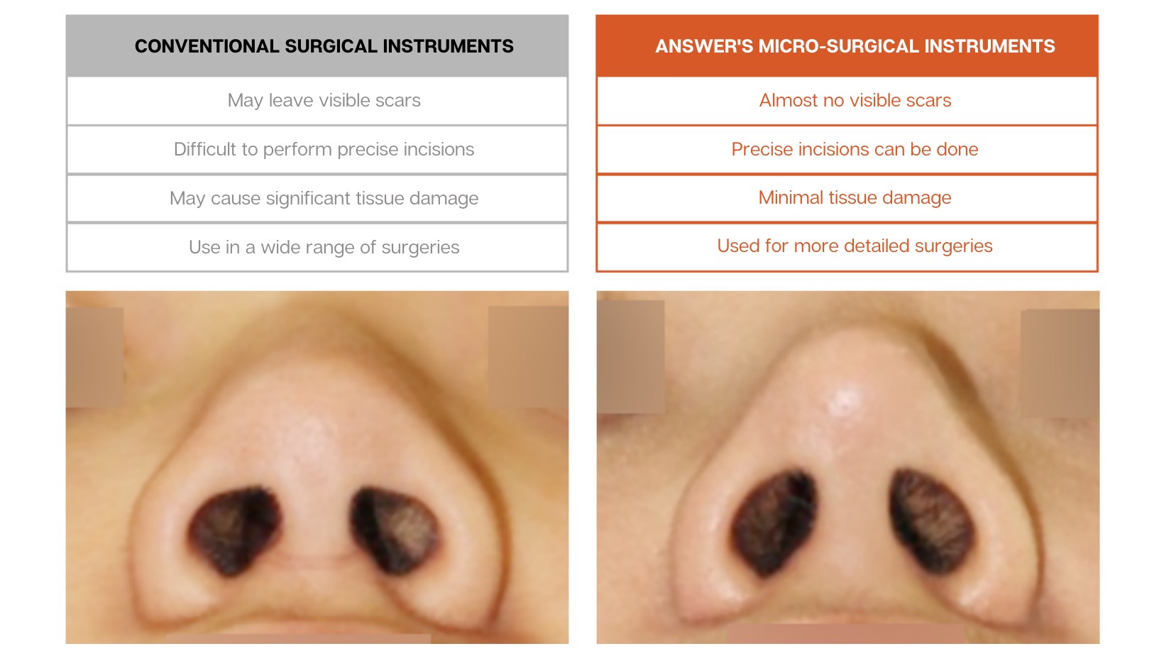 Curved Nose Rhinoplasty Curved Nose Rhinoplasty