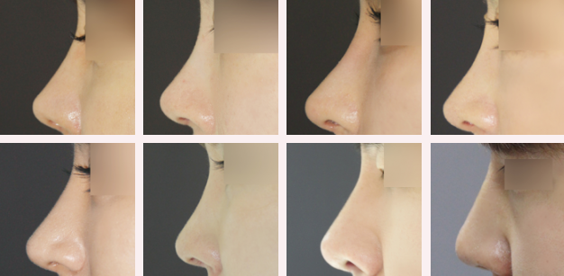 Answer Plastic Surgery Korea