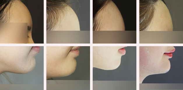 Answer Plastic Surgery Korea