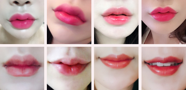 Answer Plastic Surgery Korea
