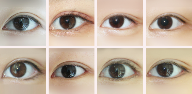 Answer Plastic Surgery Korea