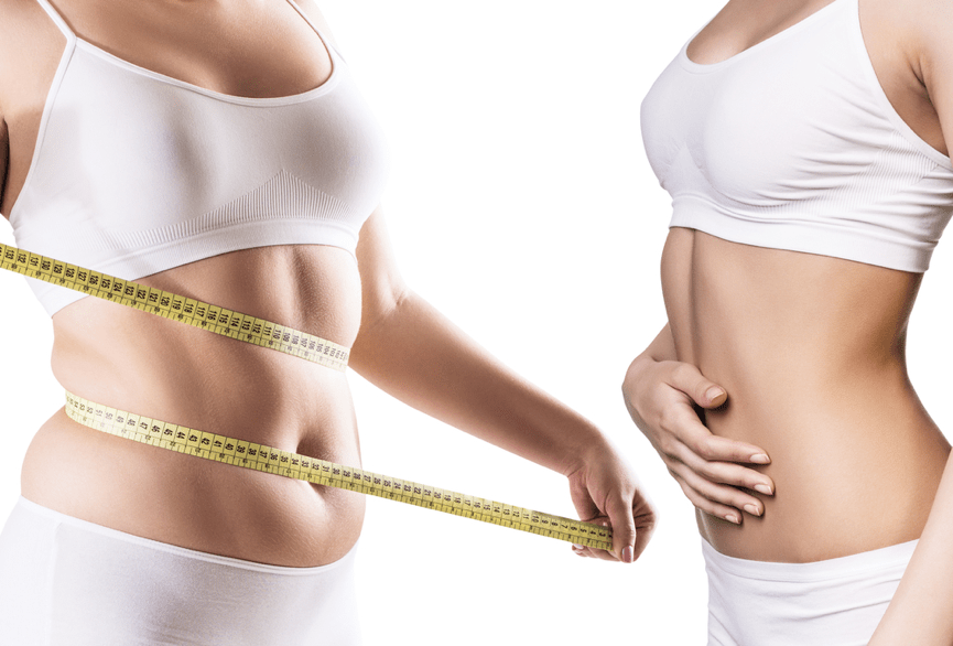 Liposuction in Korea