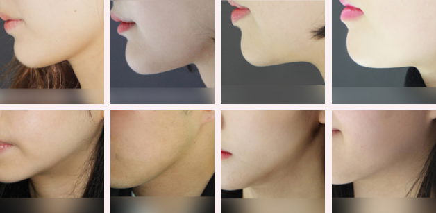 Answer Plastic Surgery Korea