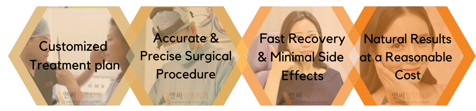 RHINOPLASTY RHINOPLASTY