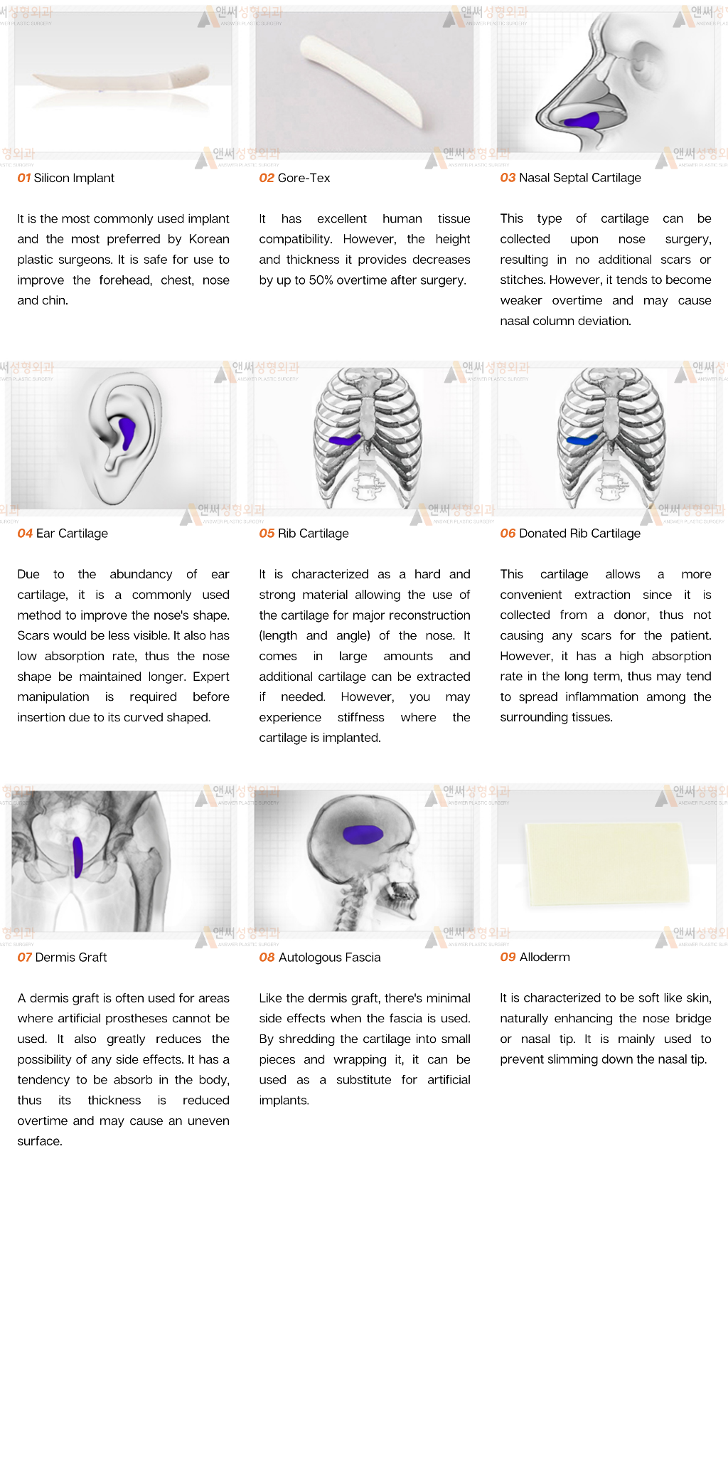 RHINOPLASTY RHINOPLASTY