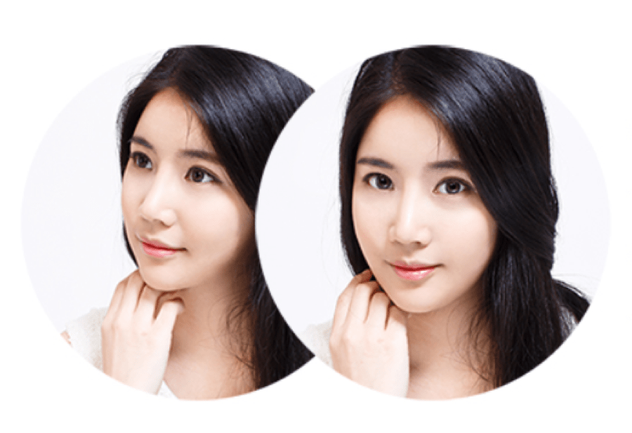 Downward Pointing Tip Correction