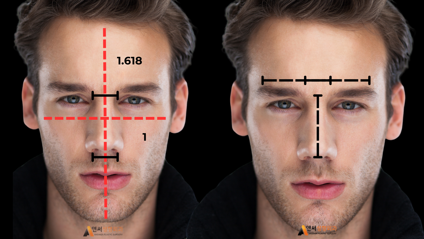 Men’s Rhinoplasty Men’s Rhinoplasty