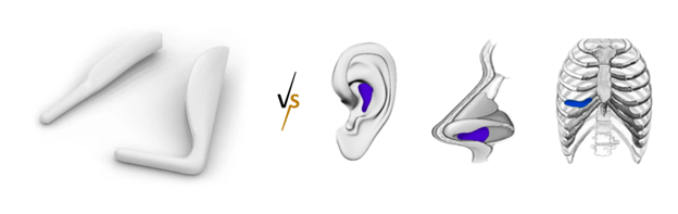Why are Silicone Implants Usually Better than Cartilage Grafts When Enhancing the Nose Bridge? Why are Silicone Implants Usually Better than Cartilage Grafts When Enhancing the Nose Bridge?