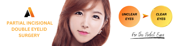Partial Incisional Double Eyelid Surgery
Partial Incisional Double Eyelid Surgery