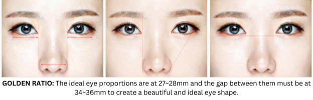 Incisional Double Eyelid Surgery Incisional Double Eyelid Surgery