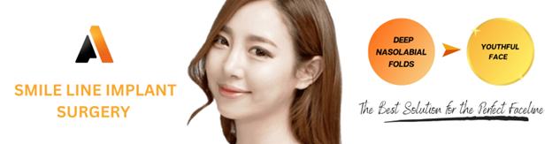 Smile Line Implant Surgery Smile Line Implant Surgery