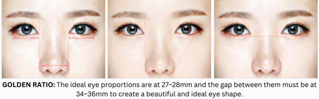 Revision Eye Surgery