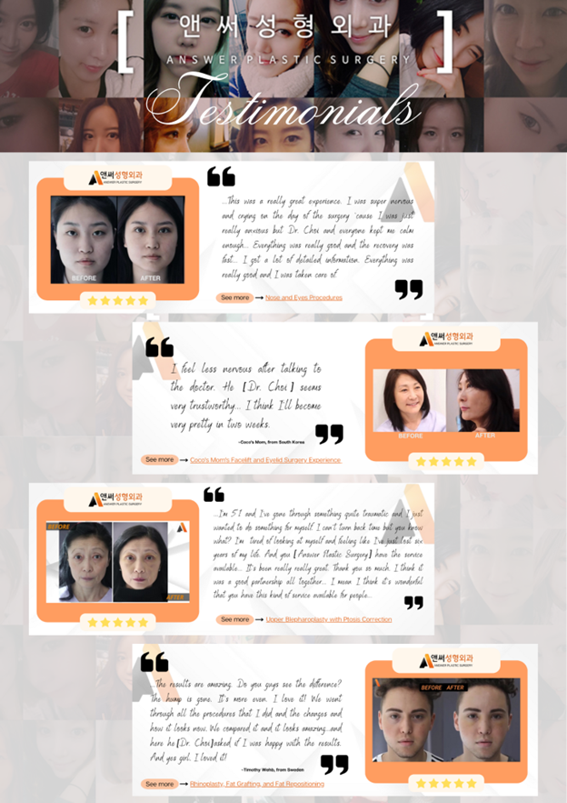 Partial Incisional Double Eyelid Surgery
Partial Incisional Double Eyelid Surgery