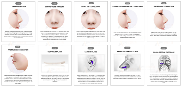 Rhinoplasty in Korea: Your 2024 Guide to Getting the Procedure Rhinoplasty in Korea: Your 2024 Guide to Getting the Procedure