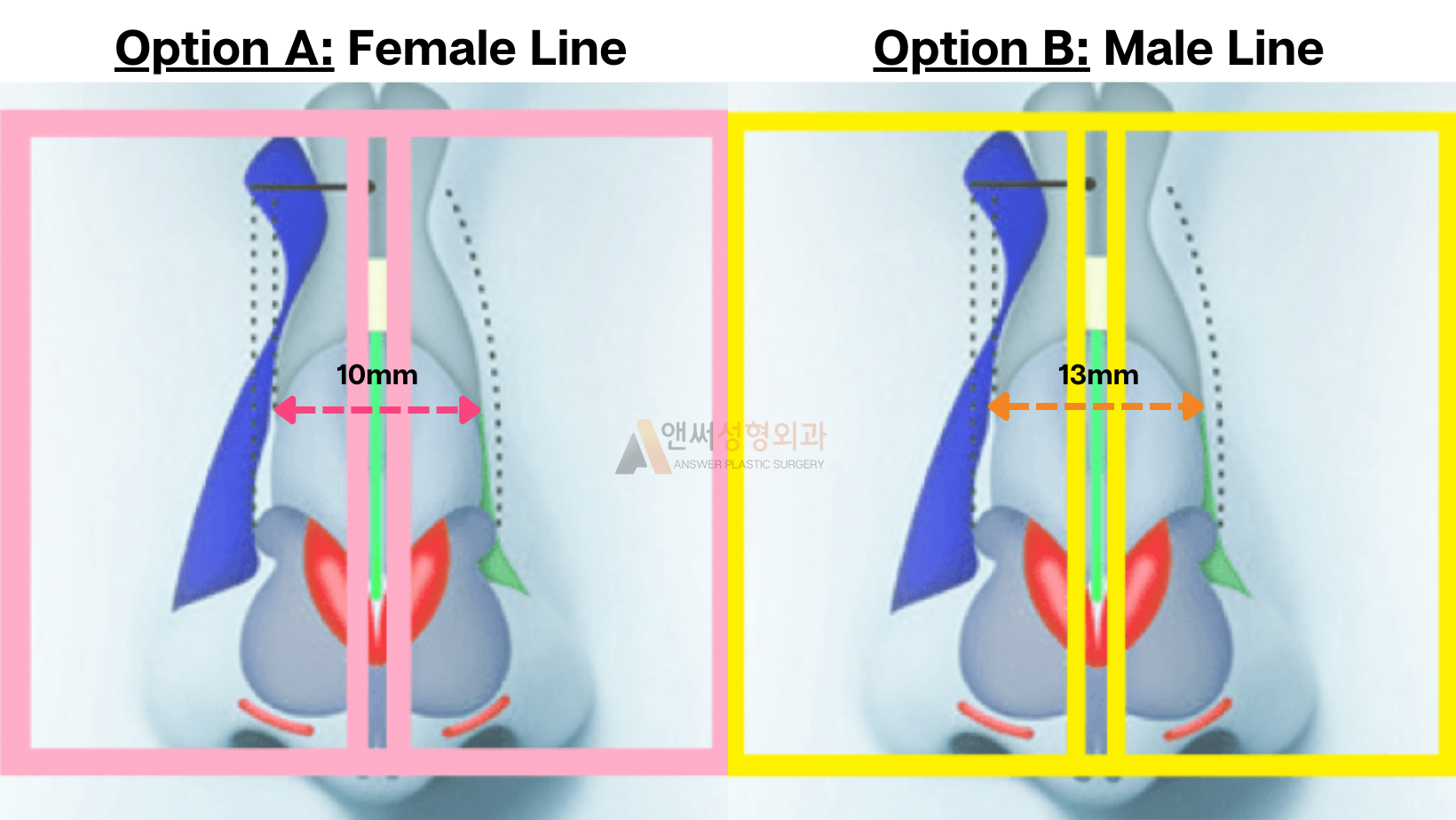 Nose Bridge Correction and Augmentation Nose Bridge Correction and Augmentation